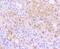 Insulin Receptor Related Receptor antibody, A08212-1, Boster Biological Technology, Immunohistochemistry frozen image 