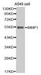 Matrix Metallopeptidase 1 antibody, MBS128960, MyBioSource, Western Blot image 