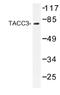 Transforming Acidic Coiled-Coil Containing Protein 3 antibody, AP01187PU-N, Origene, Western Blot image 