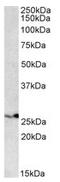 Proteasome Subunit Beta 4 antibody, AP21517PU-N, Origene, Western Blot image 
