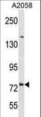 Delta/Notch Like EGF Repeat Containing antibody, LS-C157690, Lifespan Biosciences, Western Blot image 