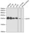 GST3 antibody, GTX32639, GeneTex, Western Blot image 