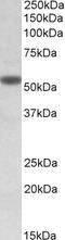 Cholinergic Receptor Nicotinic Alpha 5 Subunit antibody, EB10968, Everest Biotech, Western Blot image 