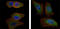 AKT Serine/Threonine Kinase 2 antibody, M00725-2, Boster Biological Technology, Western Blot image 