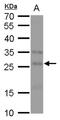 Fibroblast Growth Factor 18 antibody, PA5-78261, Invitrogen Antibodies, Western Blot image 