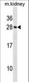 Recoverin antibody, LS-C158240, Lifespan Biosciences, Western Blot image 