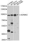G Protein-Coupled Receptor Kinase 3 antibody, A2049, ABclonal Technology, Western Blot image 