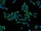 Myotubularin 1 antibody, 13924-1-AP, Proteintech Group, Immunofluorescence image 