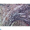 Integrin Subunit Alpha E antibody, LS-C814244, Lifespan Biosciences, Immunohistochemistry paraffin image 