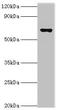 Glutamate Decarboxylase 1 antibody, orb353069, Biorbyt, Western Blot image 