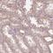 Transmembrane Protein 151B antibody, HPA055167, Atlas Antibodies, Immunohistochemistry paraffin image 