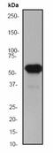 Keratin 5 antibody, ab52635, Abcam, Western Blot image 