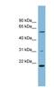 TP53RK Binding Protein antibody, NBP1-56860, Novus Biologicals, Western Blot image 