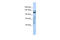 Zinc Finger Protein 451 antibody, ARP39198_P050, Aviva Systems Biology, Western Blot image 