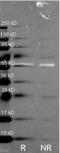 Catalase antibody, orb87396, Biorbyt, Western Blot image 