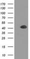Doublecortin antibody, NBP2-03081, Novus Biologicals, Western Blot image 