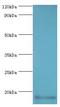 Calmodulin-like protein 5 antibody, LS-B15168, Lifespan Biosciences, Western Blot image 