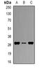 Major Histocompatibility Complex, Class II, DP Beta 1 antibody, orb340751, Biorbyt, Western Blot image 