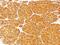 Tyrosinase antibody, NBP2-33160, Novus Biologicals, Immunohistochemistry paraffin image 