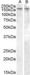 Arginine Vasopressin Receptor 1B antibody, LS-B5241, Lifespan Biosciences, Western Blot image 