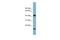 Biogenesis Of Ribosomes BRX1 antibody, A13874, Boster Biological Technology, Western Blot image 