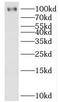 HECT Domain E3 Ubiquitin Protein Ligase 3 antibody, FNab03820, FineTest, Western Blot image 