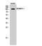 ADAM Metallopeptidase With Thrombospondin Type 1 Motif 1 antibody, STJ91477, St John