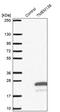 Transmembrane Protein 138 antibody, PA5-59960, Invitrogen Antibodies, Western Blot image 