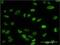 Calcineurin A antibody, H00005530-M03, Novus Biologicals, Immunocytochemistry image 