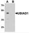 UbiA Prenyltransferase Domain Containing 1 antibody, NBP2-82046, Novus Biologicals, Western Blot image 