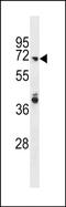 Rho GTPase Activating Protein 40 antibody, PA5-72085, Invitrogen Antibodies, Western Blot image 