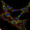 Eukaryotic Translation Elongation Factor 2 antibody, LS-C812575, Lifespan Biosciences, Immunohistochemistry paraffin image 