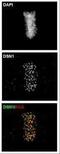 DSN1 Component Of MIS12 Kinetochore Complex antibody, PA5-34879, Invitrogen Antibodies, Immunofluorescence image 