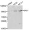 Insulin Receptor Substrate 1 antibody, abx000630, Abbexa, Western Blot image 