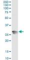 RAB32, Member RAS Oncogene Family antibody, H00010981-M01, Novus Biologicals, Immunoprecipitation image 