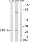RAB18, Member RAS Oncogene Family antibody, PA5-39400, Invitrogen Antibodies, Western Blot image 