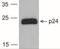 HIV-1 gp24 antibody, NBP2-41339, Novus Biologicals, Western Blot image 