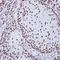 Spliceosome Associated Factor 1, Recruiter Of U4/U6.U5 Tri-SnRNP antibody, orb69722, Biorbyt, Immunohistochemistry paraffin image 