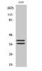 Linker For Activation Of T Cells antibody, STJ93904, St John