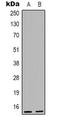 Nuclear Transport Factor 2 antibody, LS-C368705, Lifespan Biosciences, Western Blot image 