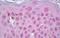 Vitamin D Receptor antibody, ab134826, Abcam, Immunohistochemistry paraffin image 