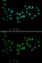DNA Methyltransferase 3 Alpha antibody, GTX33161, GeneTex, Immunocytochemistry image 