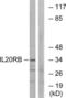 Interleukin 20 Receptor Subunit Beta antibody, LS-C119526, Lifespan Biosciences, Western Blot image 