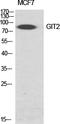 GIT ArfGAP 2 antibody, A04441, Boster Biological Technology, Western Blot image 