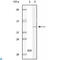 Calcium And Integrin Binding 1 antibody, LS-C812426, Lifespan Biosciences, Immunohistochemistry paraffin image 