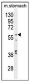 Glypican 3 antibody, AP13408PU-N, Origene, Western Blot image 