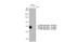 P21 (RAC1) Activated Kinase 4 antibody, GTX03256, GeneTex, Western Blot image 