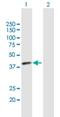 Tissue Specific Transplantation Antigen P35B antibody, H00007264-B01P, Novus Biologicals, Western Blot image 