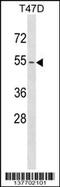 Keratin 79 antibody, 59-383, ProSci, Western Blot image 