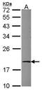 Ubiquitin Conjugating Enzyme E2 G1 antibody, GTX114869, GeneTex, Western Blot image 